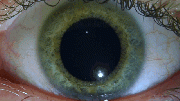 Auge Pupille Reflex.gif